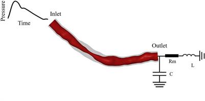 Accurate Calculation of FFR Based on a Physics-Driven Fluid‐Structure Interaction Model